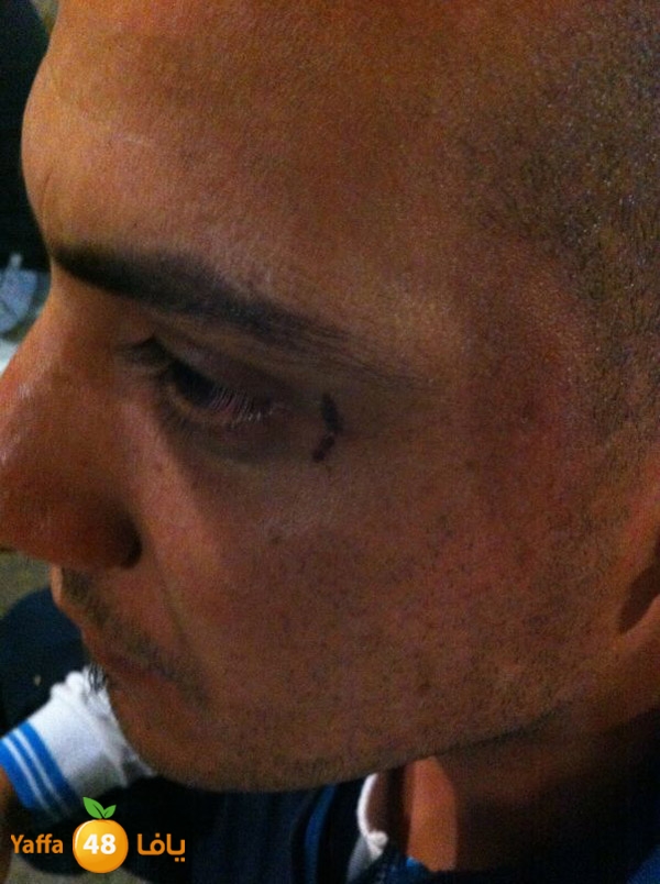 phoneludinjury (6).JPG